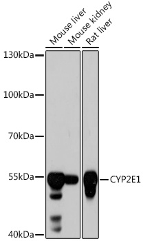 CYP2E1 Antibody