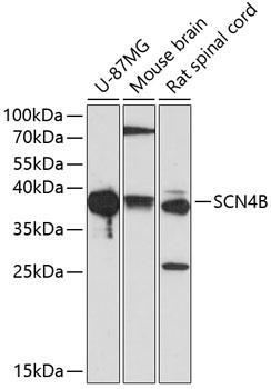 SCN4B Antibody