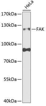 PTK2 Antibody