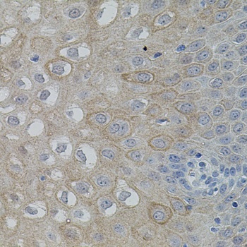 PTK2 Antibody