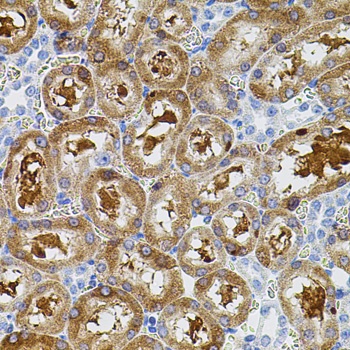 PTK2 Antibody
