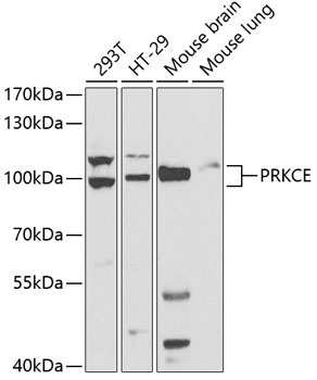 PRKCE Antibody