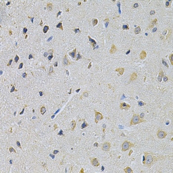 PPA1 Antibody