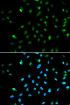 POLR2A Antibody