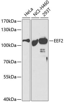 EEF2 Antibody