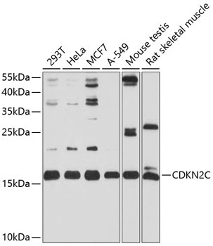 CDKN2C Antibody