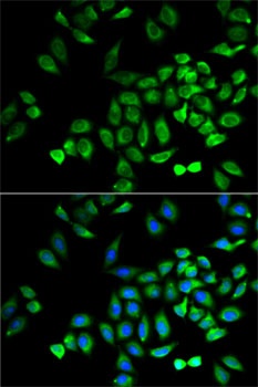 ANGPTL4 Antibody