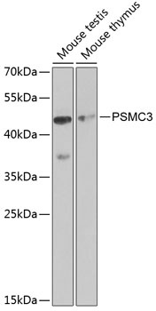 PSMC3 Antibody