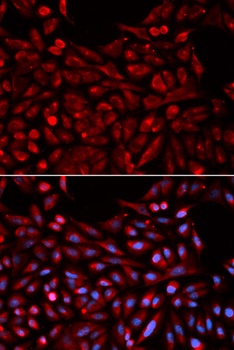 NR1I3 Antibody