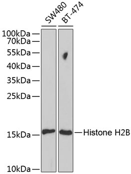 HIST2H2BE Antibody