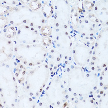 HIST2H2BE Antibody