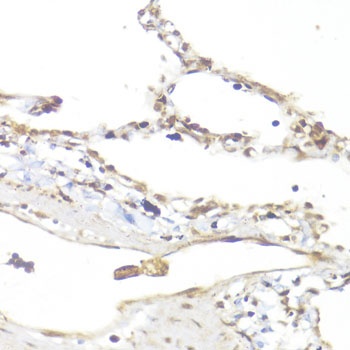 Smad5 Antibody