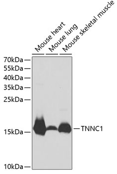 TNNC1 Antibody