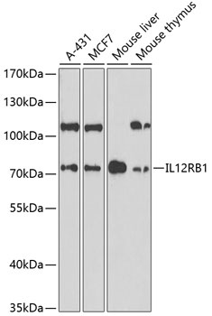 IL12RB1 Antibody