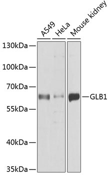 GLB1 Antibody