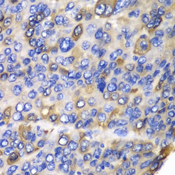 CES1 Antibody