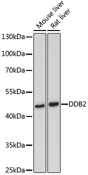 DDB2 Antibody