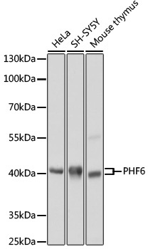 PHF6 Antibody