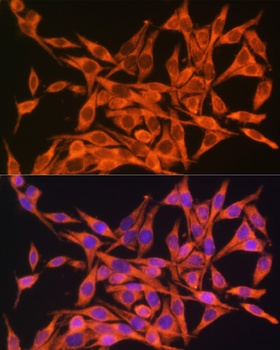 MT-ATP8 Antibody