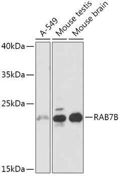 RAB7B Antibody