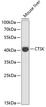 CTSK Antibody