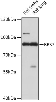 BBS7 Antibody