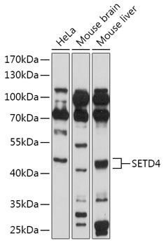 SETD4 Antibody