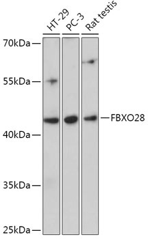 FBXO28 Antibody