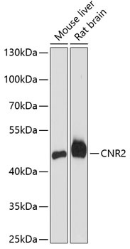 CNR2 Antibody