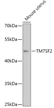 TM7SF2 Antibody