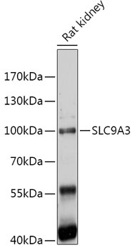 SLC9A3 Antibody
