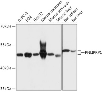 PNLIPRP1 Antibody