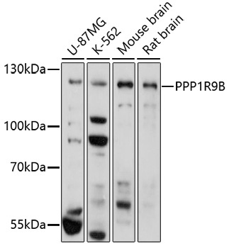 PPP1R9B Antibody
