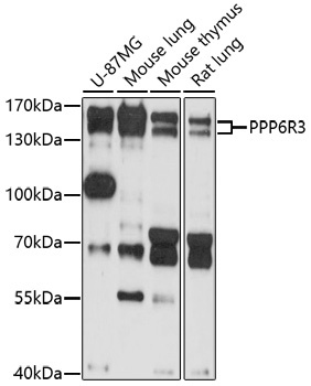 PPP6R3 Antibody