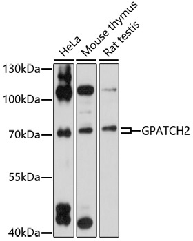 GPATCH2 Antibody