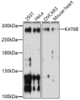 KAT6B Antibody