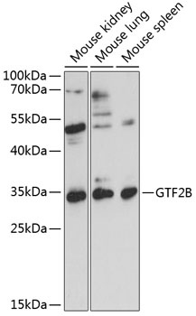 GTF2B Antibody