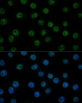 GTF2B Antibody