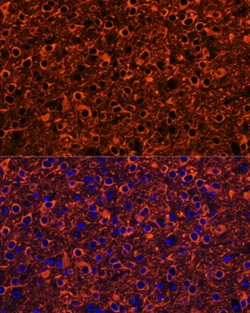 TUBB3 Antibody