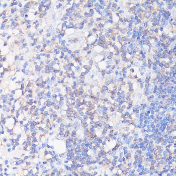 CFL1 Antibody