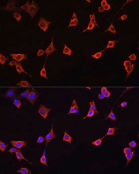 CFL1 Antibody