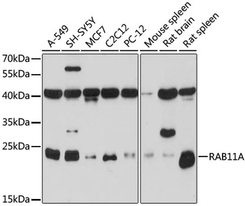 RAB11A Antibody