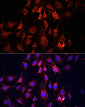 UCP3 Antibody