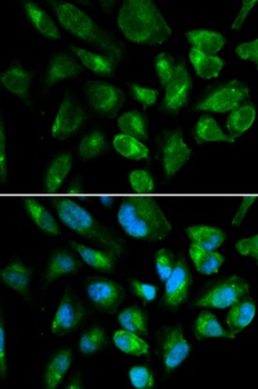 KIR2DL3 Antibody