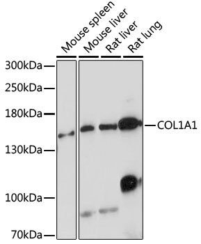 COL1A1 Antibody