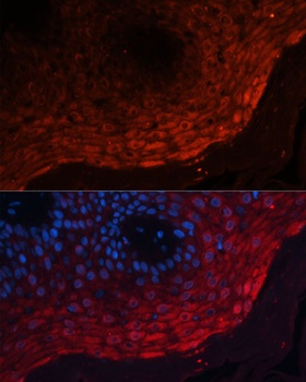 S100A8 Antibody