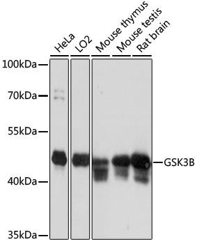 GSK3B Antibody