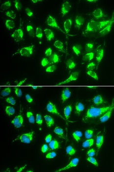 SLC22A5 Antibody