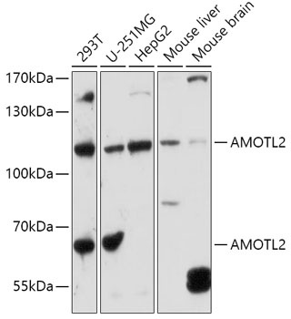 AMOTL2 Antibody