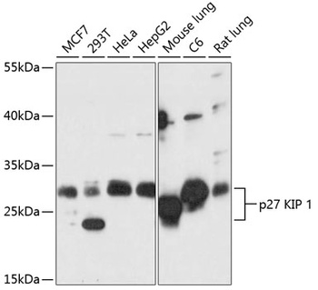 CDKN1B Antibody